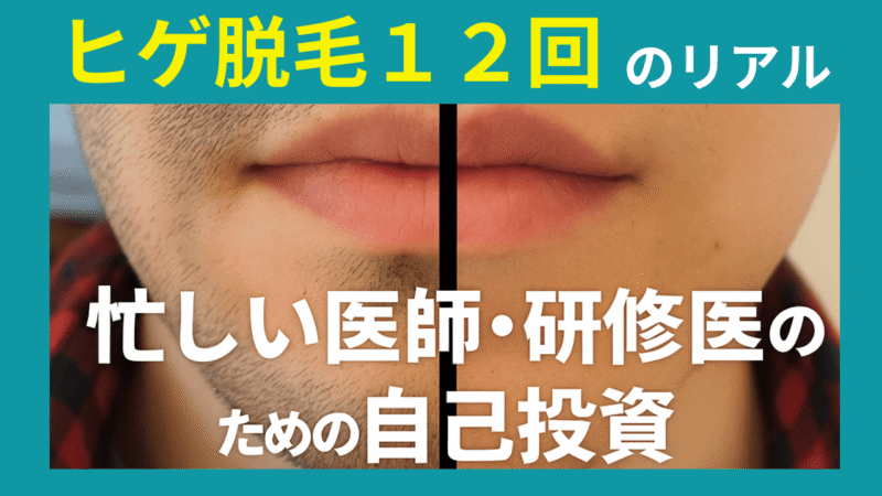 忙しい医師・研修医こそ読みたい「湘南美容外科ヒゲ脱毛12回」体験談を紹介します 